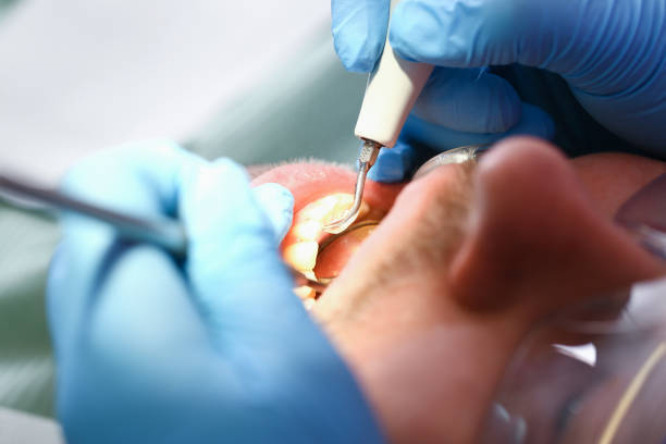Best Emergency Dentist for Knocked-Out Tooth in Grayling, MI